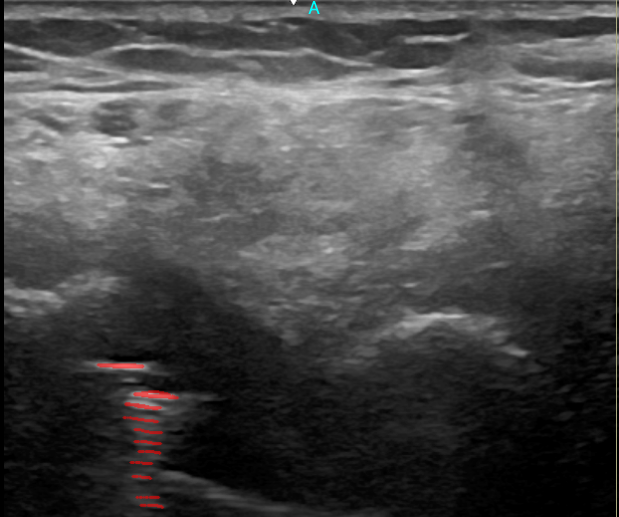 Artefacto metálico con etiquetas anatómicas