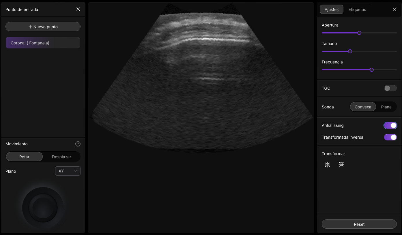 Simulación de artefacto de reverberación en diferentes tejidos