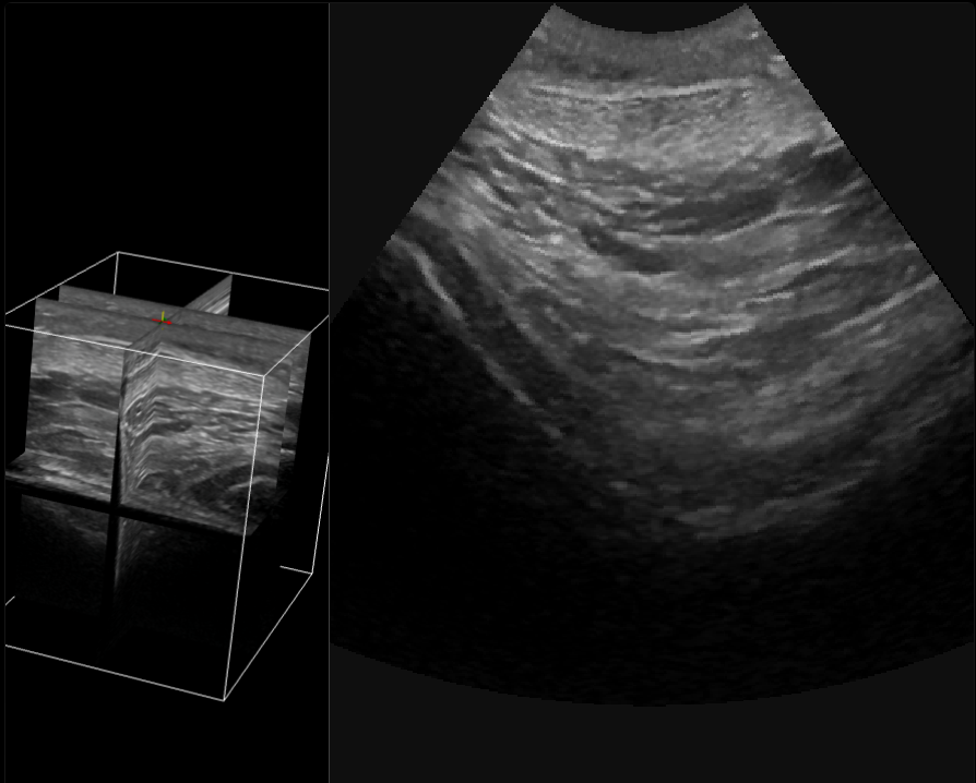 Interacción Sonido con tejidos: Just do It!