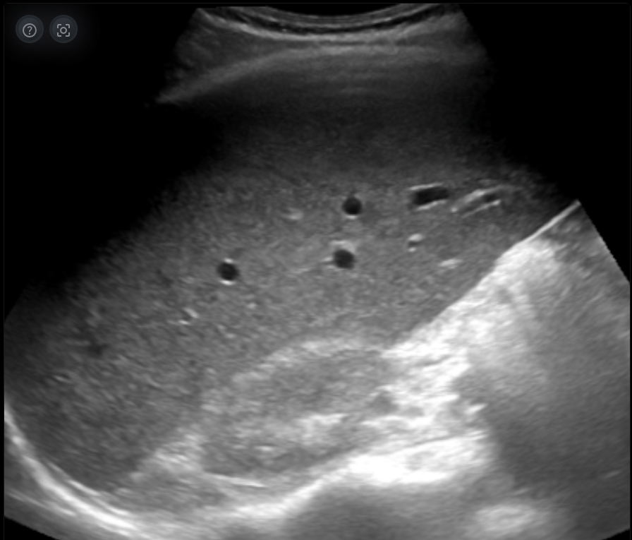 Ganancia en ecografía