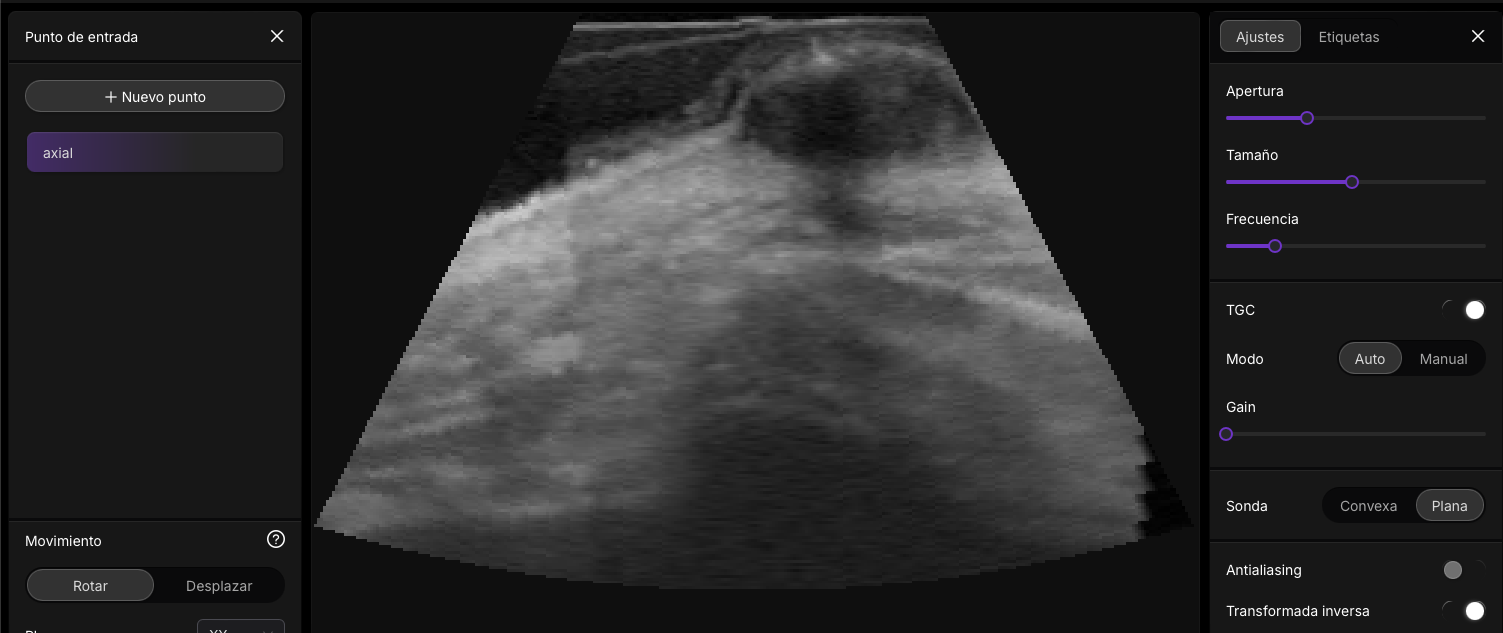 Ecogenicidad en ecografía