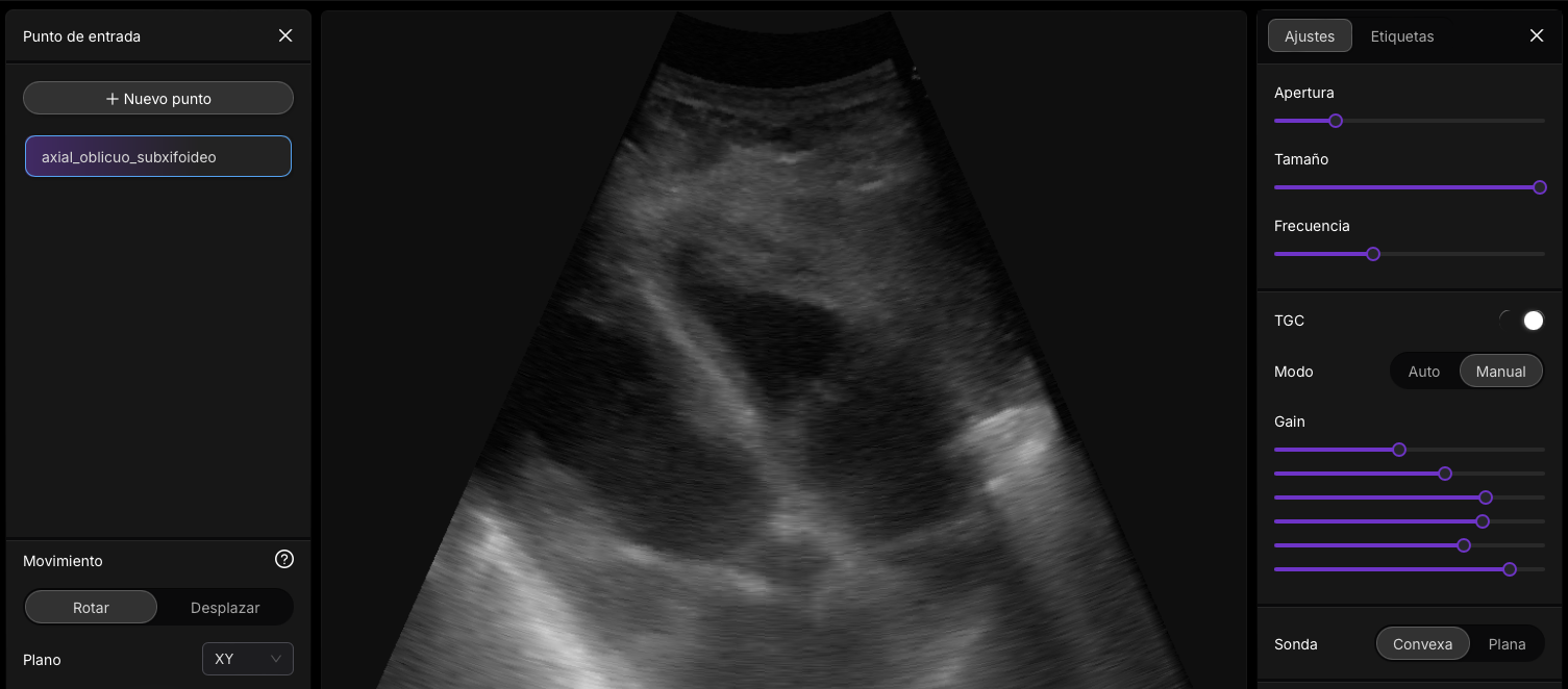 Pasos básicos del camino de los ultrasonidos