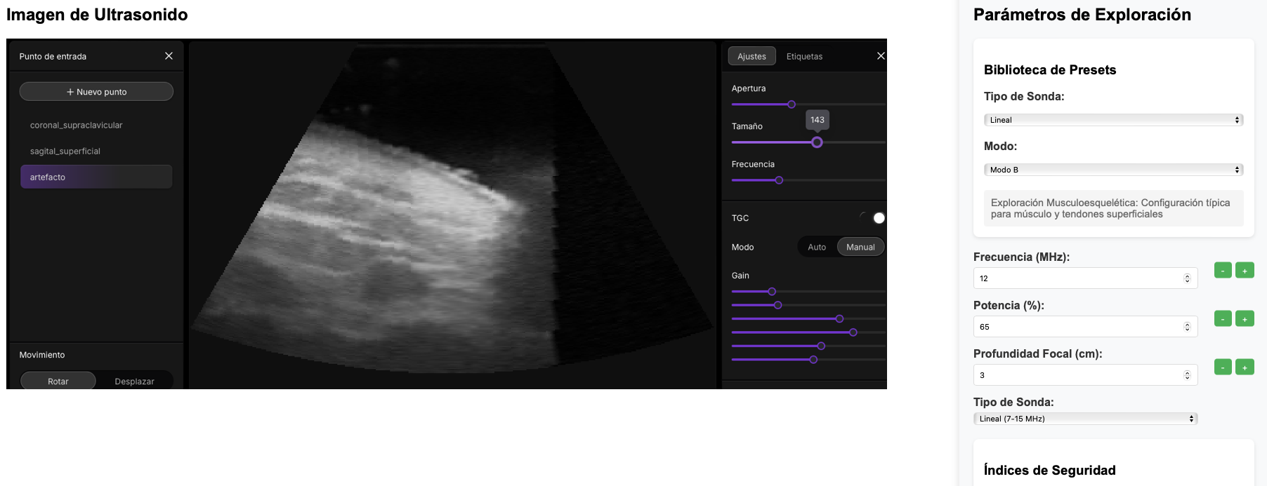 Pasos básicos del camino de los ultrasonidos