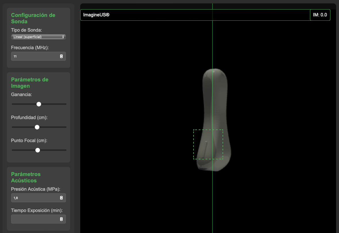 Pasos básicos del camino de los ultrasonidos