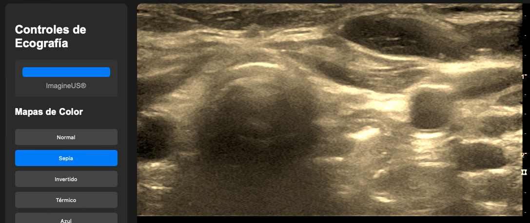 Pasos básicos del camino de los ultrasonidos