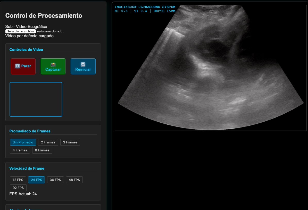 Pasos básicos del camino de los ultrasonidos