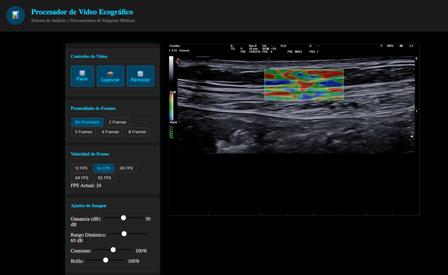 Pasos básicos del camino de los ultrasonidos