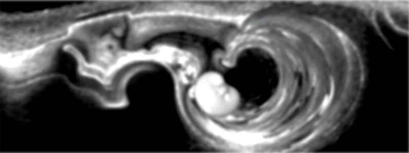 Imagen de ultrasonido de un feto, en escala de grises