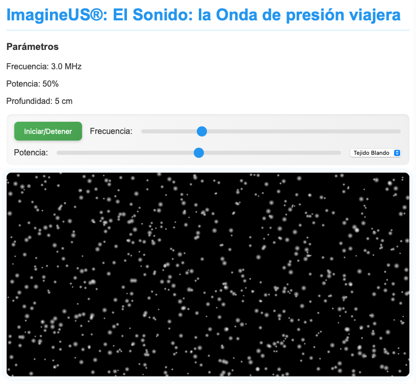 Pasos básicos del camino de los ultrasonidos